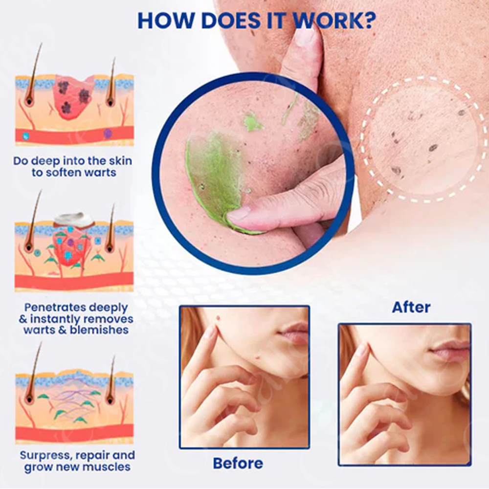 Το NatureErase Άμεσο Τζελ Αφαίρεσης Σπίλων & Κηλίδων