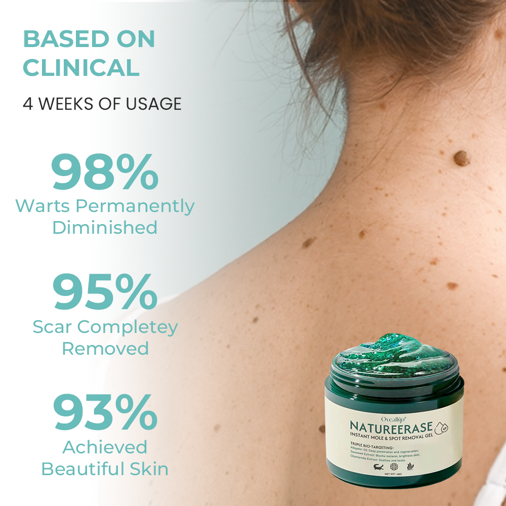 Το NatureErase Άμεσο Τζελ Αφαίρεσης Σπίλων & Κηλίδων