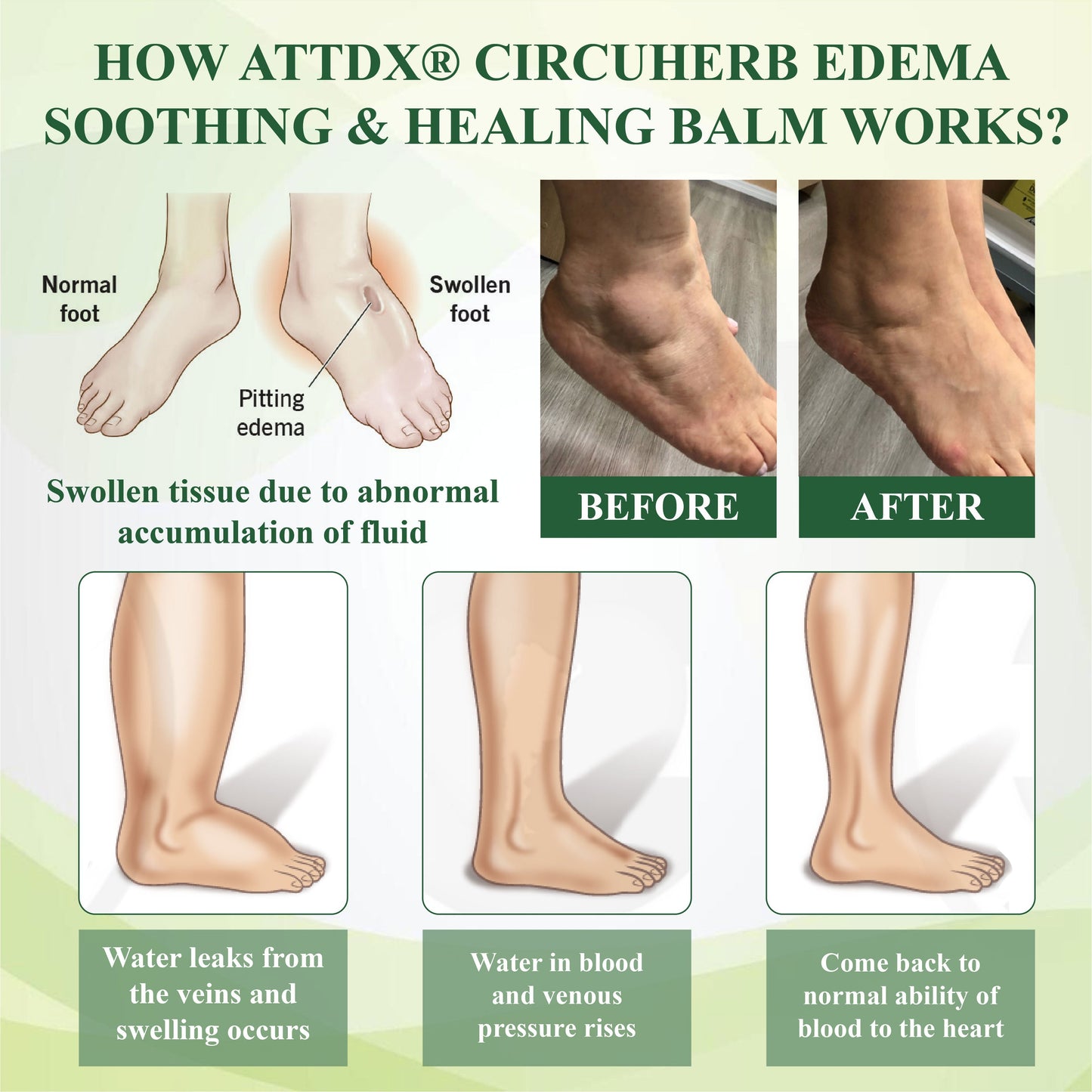 CircuHerb Βάλσαμο Καταπράυνσης & Επούλωσης για Οίδημα 2