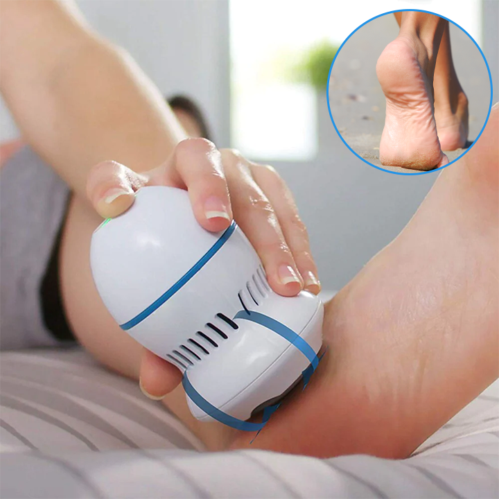 Ηλεκτρική Μηχανή Αφαίρεσης Κάλων & Νεκρών Κυττάρων!