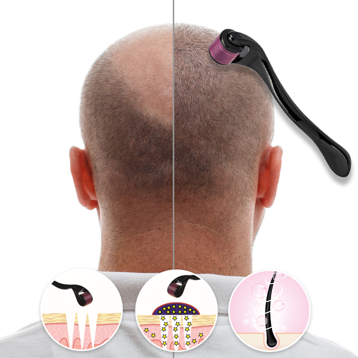 Κύλινδρος Για Την Αντιμετώπιση της Τριχόπτωσης & των Ραγάδων