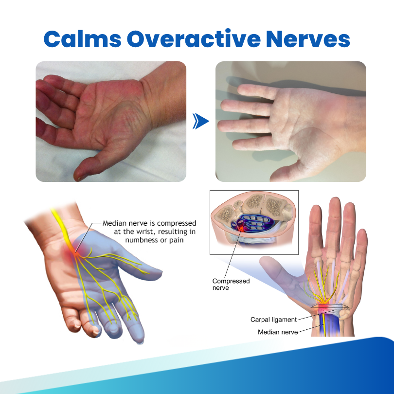 Θεραπευτικό Σπρέι για Νευροπάθεια