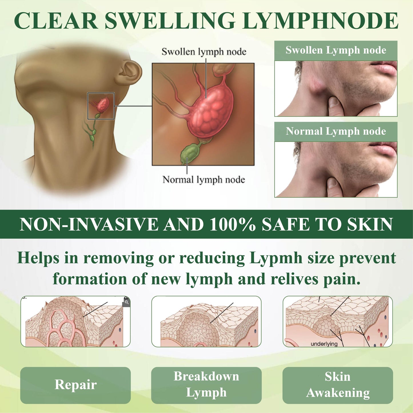 Κρέμα Θεραπείας Ποδιών για Οίδημα